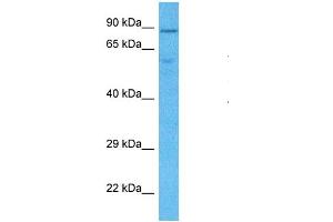 Host:  Rabbit  Target Name:  LETM1  Sample Type:  MDA-MB-435s Whole Cell lysates  Antibody Dilution:  1.