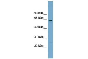 CNDP2 antibody used at 1 ug/ml to detect target protein. (CNDP2 Antikörper)