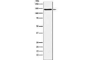 Western blot analysis of TAG1 expression in U87-MG cell lysate.