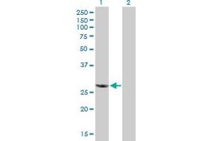 Western Blot analysis of RBCK1 expression in transfected 293T cell line by RBCK1 MaxPab polyclonal antibody. (RBCK1 Antikörper  (AA 1-230))