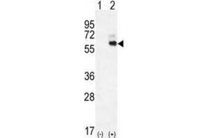 Western Blotting (WB) image for anti-Kininogen 1 (KNG1) antibody (ABIN2996315) (KNG1 Antikörper)