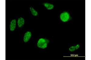 Immunofluorescence of purified MaxPab antibody to IRX2 on HeLa cell. (IRX2 Antikörper  (AA 1-471))