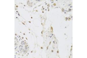 Immunohistochemistry of paraffin-embedded human breast using USP7 Antibody (ABIN5971305) at dilution of 1/100 (40x lens). (USP7 Antikörper)