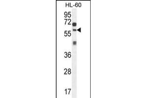ZSWIM1 Antibody (C-term) (ABIN654558 and ABIN2844265) western blot analysis in HL-60 cell line lysates (35 μg/lane). (ZSWIM1 Antikörper  (C-Term))