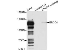 Immunoprecipitation analysis of 150ug extracts of 293T cells using 3ug ERCC4 antibody. (ERCC4 Antikörper)