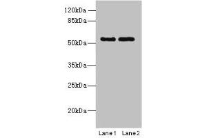 Western blot All lanes: TRIM17 antibody at 1 μg/mL Lane 1: U87 whole cell lysate Lane 2: K562 whole cell lysate Secondary Goat polyclonal to rabbit IgG at 1/10000 dilution Predicted band size: 55, 40 kDa Observed band size: 55 kDa (TRIM17 / RNF16 Antikörper  (AA 1-300))