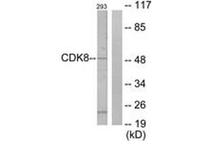 Western blot analysis of extracts from 293 cells, using CDK8 Antibody. (CDK8 Antikörper  (AA 1-50))
