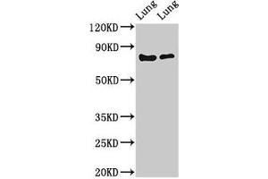 Western Blot Positive WB detected in: Rat lung tissue, Mouse lung tissue All lanes: FOXP1 antibody at 2 μg/mL Secondary Goat polyclonal to rabbit IgG at 1/50000 dilution Predicted band size: 76, 55, 66, 75, 13, 67, 78 kDa Observed band size: 76 kDa (FOXP1 Antikörper  (AA 541-677))
