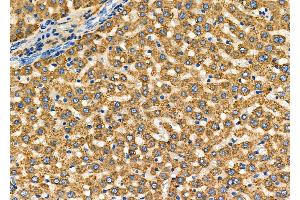ABIN6261717 and ABIN6278027 at 1/100 staining Rat liver tissue by IHC-P.