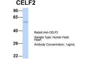 Host:  Rabbit  Target Name:  CELF2  Sample Type:  Human Fetal Heart  Antibody Dilution:  1. (CELF2 Antikörper  (N-Term))