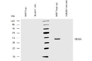 Western blotting analysis of human CD326 using mouse monoclonal antibody VU-1D9 on lysates of MCF-7 cells and HEK293T cells (negative control) under reducing and non-reducing conditions. (EpCAM Antikörper)