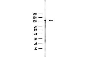 anti-Eukaryotic Elongation Factor-2 Kinase (EEF2K) (pSer366) antibody