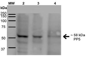 Western Blot analysis of Human A431, HEK293, and Jurkat cell lysates showing detection of ~58 kDa PP5 protein using Mouse Anti-PP5 Monoclonal Antibody, Clone 2E11 . (PP5 Antikörper  (Alkaline Phosphatase (AP)))