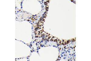 Immunohistochemistry (IHC) image for anti-Mitogen-Activated Protein Kinase 1/3 (MAPK1/3) (pThr185), (pThr202) antibody (ABIN7268610)