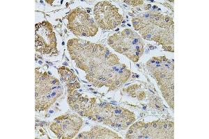 Immunohistochemistry of paraffin-embedded human stomach using PTCD3 antibody. (PTCD3 Antikörper  (AA 450-689))