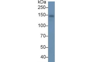 Detection of CP in Human Serum using Monoclonal Antibody to Ceruloplasmin (CP) (Ceruloplasmin Antikörper  (AA 789-1065))