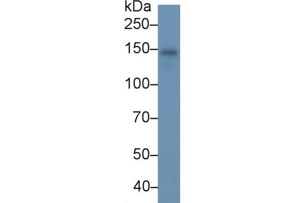 Ceruloplasmin Antikörper  (AA 789-1065)