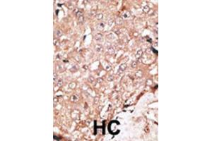 Immunohistochemistry (IHC) image for anti-Lysine (K)-Specific Demethylase 1A (KDM1A) antibody (ABIN2996581) (LSD1 Antikörper)