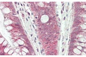 Immunohistochemistry (IHC) image for anti-DNA-Damage-Inducible Transcript 3 (DDIT3) (AA 1-169) antibody (ABIN7437662)