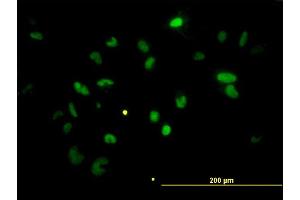 Immunofluorescence of monoclonal antibody to CHEK2 on HeLa cell. (CHEK2 Antikörper  (AA 1-543))