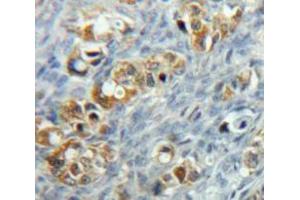 Used in DAB staining on fromalin fixed paraffin-embedded Ovary tissue (MCL-1 Antikörper  (AA 6-328))