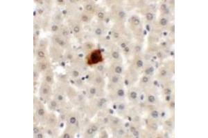 Immunohistochemistry (IHC) image for anti-Etoposide Induced 2.4 (EI24) (C-Term) antibody (ABIN1030379) (EI24 Antikörper  (C-Term))