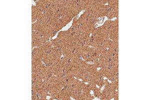 Immunohistochemical analysis of paraffin-embedded human brain tissue using (ABIN656416 and ABIN2845709) performed on the Leica® BOND RXm. (APG8b (AA 9-33), (N-Term) Antikörper)
