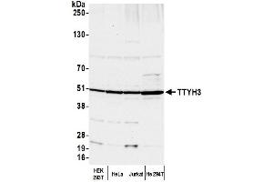 anti-Tweety Homolog 3 (TTYH3) (AA 425-475) antibody