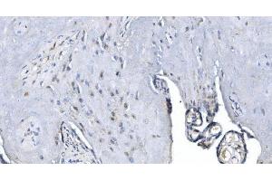 Figure 4 IHC analysis of METTL3 using anti-METTL3 antibody (ABIN7602366).