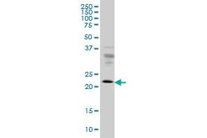 RAB9A monoclonal antibody (M01), clone 1E12 Western Blot analysis of RAB9A expression in HeLa . (RAB9A Antikörper  (AA 17-115))