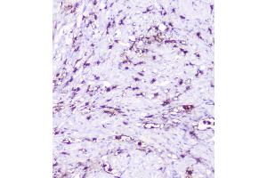 IHC analysis of CXCL12 using anti-CXCL12 antibody (ABIN6719467).
