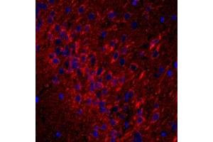 Immunofluorescent analysis of paraformaldehyde-fixed rat brain using,CD63 (ABIN7073400) at dilution of 1: 1500 (CD63 Antikörper)