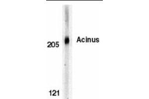 Western blot analysis of Acinus in K562 whole cell lysate with Acinus antibody (CT) at 0. (ACIN1 Antikörper  (C-Term))