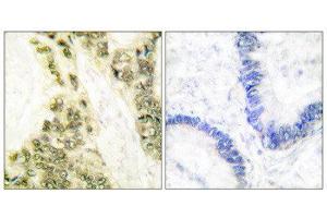 Immunohistochemistry (IHC) image for anti-Thyroid Hormone Receptor, alpha (THRA) (N-Term) antibody (ABIN1848804)