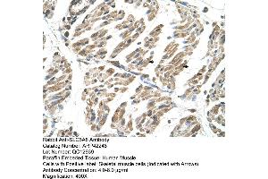 Rabbit Anti-SLC6A8 Antibody  Paraffin Embedded Tissue: Human Muscle Cellular Data: Skeletal muscle cells Antibody Concentration: 4.