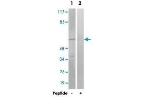 Western blot analysis of extracts from COLO 205 cells, using GRK1 polyclonal antibody .