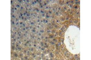 Used in DAB staining on fromalin fixed paraffin-embedded Liver tissue (APOH Antikörper  (AA 20-297))