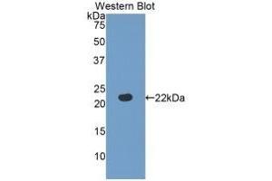 Detection of recombinant FBLN5 using Polyclonal Antibody to Fibulin 5 (FBLN5)