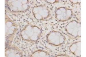 Immunohistochemistry (Paraffin-embedded Sections) (IHC (p)) image for anti-Epithelial Cell Adhesion Molecule (EPCAM) antibody (ABIN1112808)