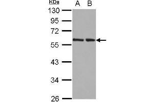 WB Image Sample (30 ug of whole cell lysate) A: 293T B: A431 12% SDS PAGE antibody diluted at 1:10000 (RAD23B Antikörper  (Center))