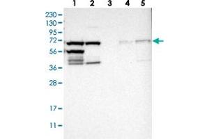 Western blot analysis of Lane 1: RT-4, Lane 2: U-251 MG, Lane 3: Human Plasma, Lane 4: Liver, Lane 5: Tonsil with TRIP4 polyclonal antibody .