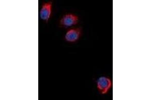 Immunofluorescent analysis of EPO Receptor staining in NIH3T3 cells. (EPOR Antikörper)