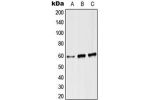 Western blot analysis of Angiopoietin-2 expression in Hela (A), Raw264. (Angiopoietin 2 Antikörper  (Center))