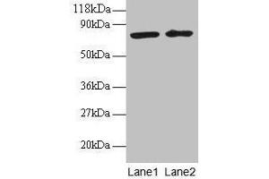 Western blot All lanes: BLOC1S1 antibody at 2 μg/mL Lane 1: EC109 whole cell lysate Lane 2: 293T whole cell lysate Secondary Goat polyclonal to rabbit IgG at 1/15000 dilution Predicted band size: 18, 15 kDa Observed band size: 75 kDa (BLOC1S1 Antikörper  (AA 1-153))