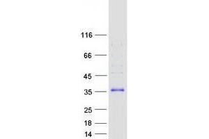Western Blotting (WB) image for Four and A Half LIM Domains 3 (FHL3) protein (Myc-DYKDDDDK Tag) (ABIN2721143)