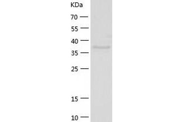 SH3GL3 Protein (AA 1-347) (His tag)