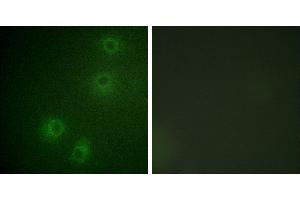 P-peptide - +Immunofluorescence analysis of COS-7 cells, using Integrin β1 (Phospho-Tyr789) antibody. (ITGB1 Antikörper  (pThr789))