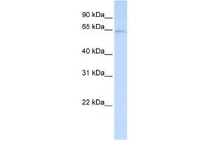 Western Blotting (WB) image for anti-Leucine Rich Repeat and Fibronectin Type III Domain Containing 3 (LRFN3) (C-Term) antibody (ABIN2783923)