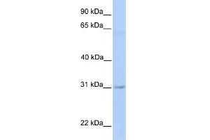 anti-Membrane-Associated Ring Finger (C3HC4) 2, E3 Ubiquitin Protein Ligase (MARCH2) (Middle Region) antibody