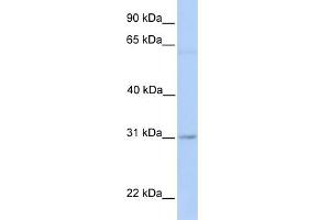 WB Suggested Anti-MARCH2 Antibody Titration:  0. (MARCH2 Antikörper  (Middle Region))